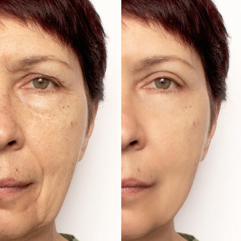 PEELING BIO ENZIMATICO 350grs - Imagen 2